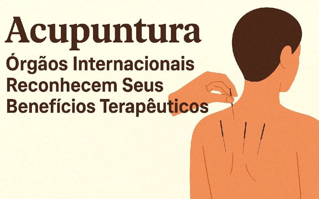 Acupuntura: Órgãos Internacionais Reconhecem Seus Benefícios Terapêuticos